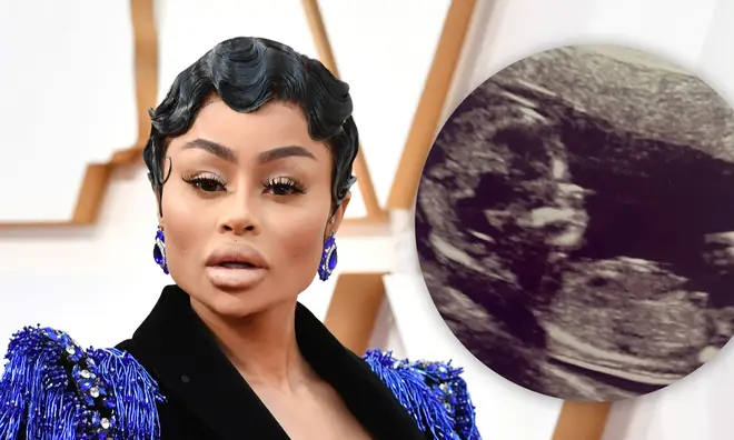 Blac Chyna confused fans this week after posting an ultrasound on Instagram.