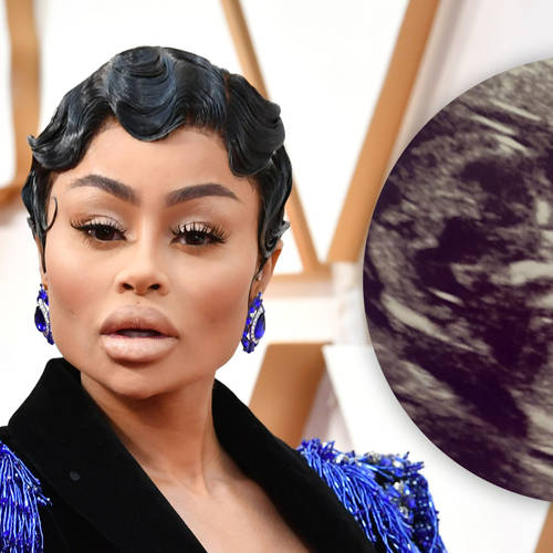 Blac Chyna confused fans this week after posting an ultrasound on Instagram.