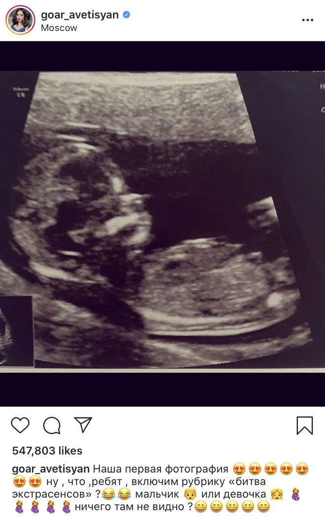 It turns out the sonogram belongs to Goar Avetisyan, a Russian makeup artists followed by Blac Chyna.