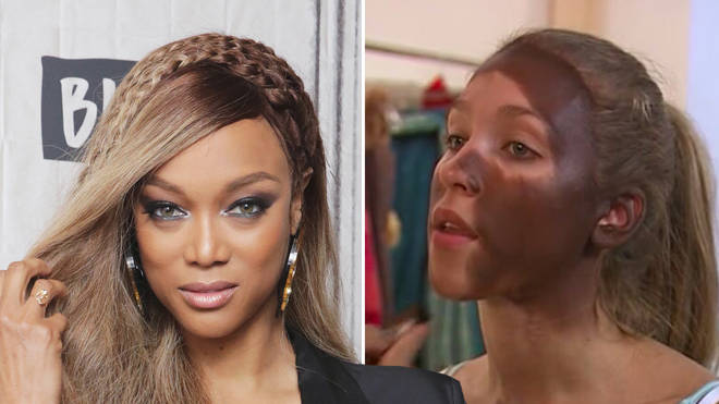 Tyra Banks is facing backlash over an &squot;bi-racial&squot; photoshoot which she insisted was "not racist".