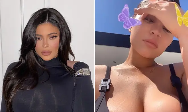 Kylie Jenner has been praised by fans for showing off the stretch marks on her breasts.