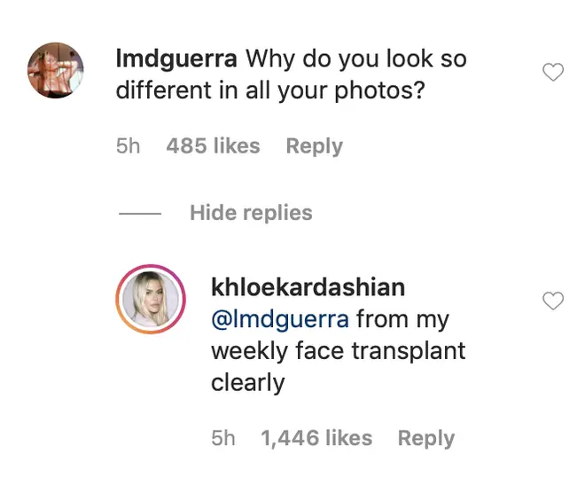 Khloe clapped back at a fan asking why she looked "different" in all of her photos.
