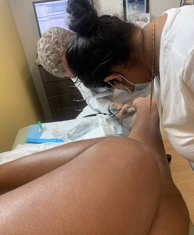 Megan Thee Stallion shares a photo of the doctors operating on her foot