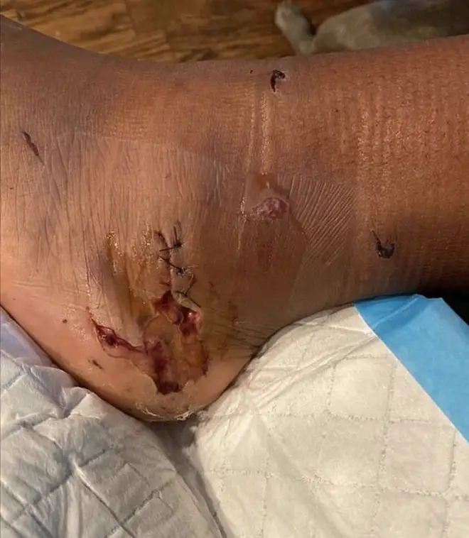 Megan Thee Stallion shares graphic photo of her gunshot wound on Instagram