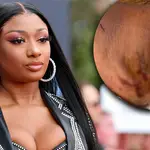 Megan Thee Stallion slams 'lying' accusations with gunshot wound photo