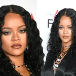 Rihanna suffers bruised face and black eye after electric scooter crash