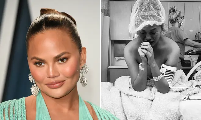 Chrissy Teigen in 'grief depression hole' after loss of baby Jack.