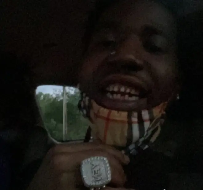 YFN Lucci shares a photo of his real teeth