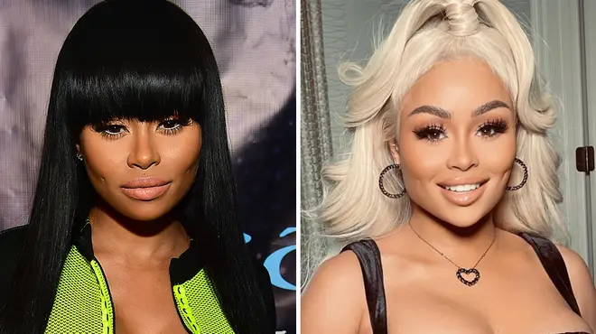 Blac Chyna sparks surgery rumours after debuting her ‘new face’