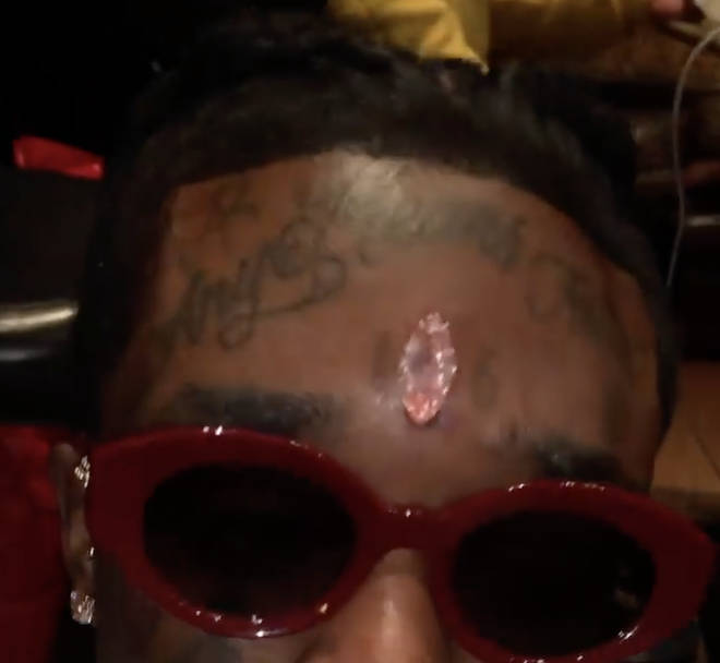 Lil Uzi Vert shows off his pink diamond implanted in his forehead