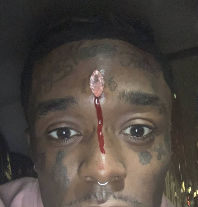 Lil Uzi Vert shares a photo of the blood dripping from his forehead piercing