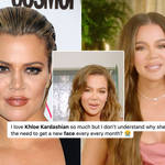 Khloe Kardashian turned the comments off of her latest Instagram post where she looks different.