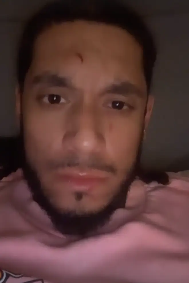 Brandon Bills shows his face following the fight with DaBaby