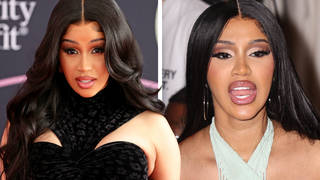 Cardi B slams troll for cheeky comment on her plastic surgery