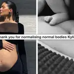 Kylie Jenner praised for showing stretch marks in post-partum belly photo