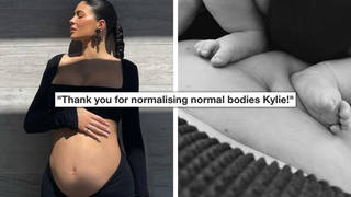 Kylie Jenner praised for showing stretch marks in post-partum belly photo