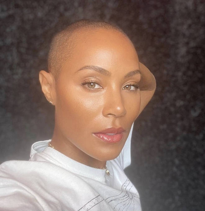 Jada Pinkett-Smith revealed her struggled with alopecia in a 2018 Red Table Talk episode.