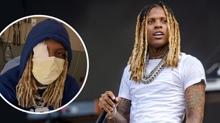 What happened to Lil Durk? The pyrotechnic incident explained