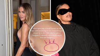 Khloe Kardashian reveals she underwent surgery to remove tumour on her face
