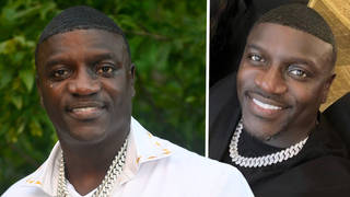 Akon roasted for Turkey hair transplant and is dubbed 'Lego man'