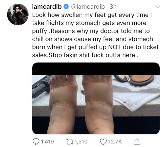 Cardi B shows why she has to cancel shows due to her surgery complicationson Twitter