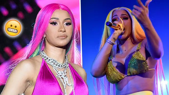Cardi B Reveals The Effects Of Her Cosmetic Surgery With Shocking Image
