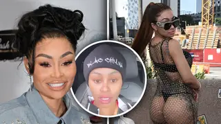 Blac Chyna admits her illegal silicon butt injections could’ve killed her