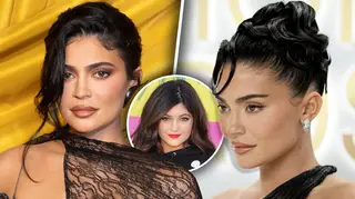 Kylie Jenner SLAMS 'misconception' that she's had 'so much surgery'