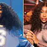 SZA opens up about reversing cosmetic surgery after ‘painful experience’