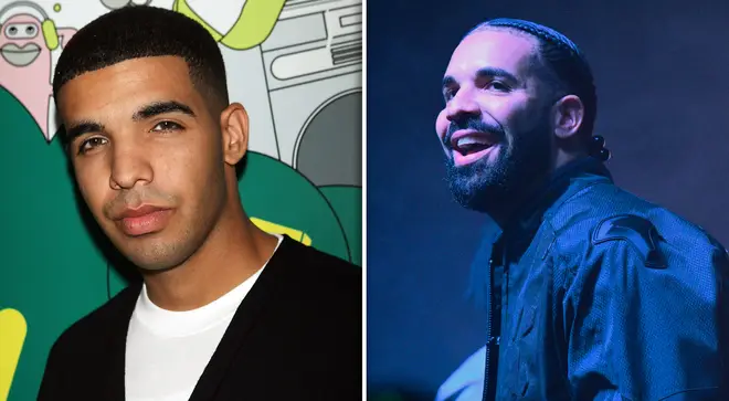 Inside Drake’s surgery rumours amid ‘nose job’ speculation