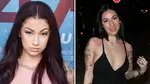 Bhad Bhabie, 21, shares before and after photos of face filler removal