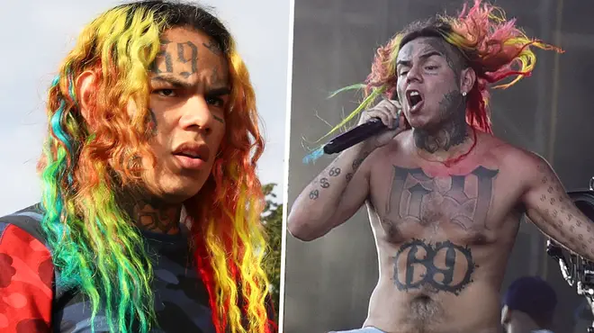 Tekashi 6ix9ine's tattoo removal process will take a year minimum